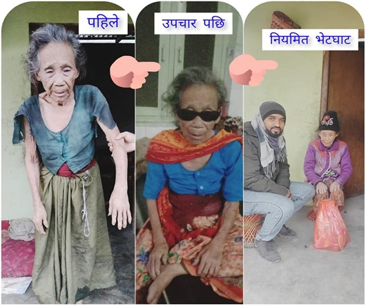 Jasako Kohi chhaina Usako Jeevan Bikas